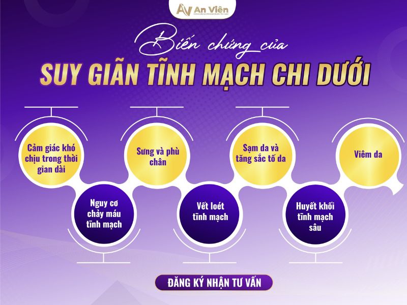 suy giãn tĩnh mạch chi dưới có nguy hiểm không