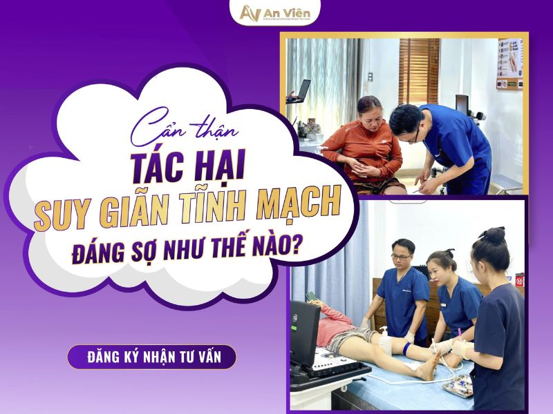 suy giãn tĩnh mạch chi dưới có nguy hiểm không