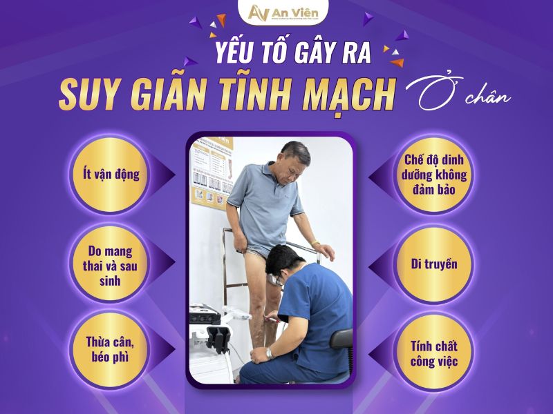 tại sao bị giãn tĩnh mạch ở chân