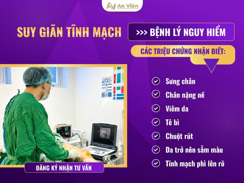 tại sao bị giãn tĩnh mạch ở chân