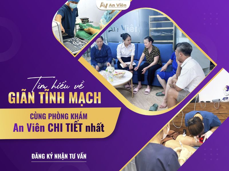 triệu chứng của giãn tĩnh mạch chân