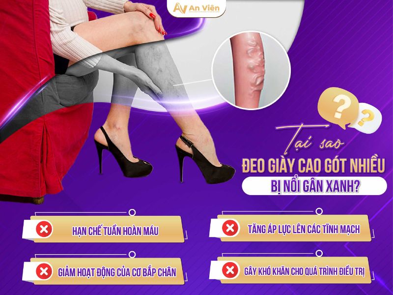 nguyên nhân giãn tĩnh mạch chân