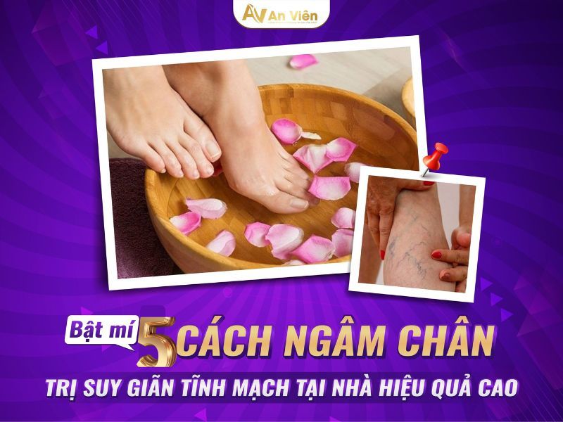 viêm tắc tĩnh mạch bàn chân