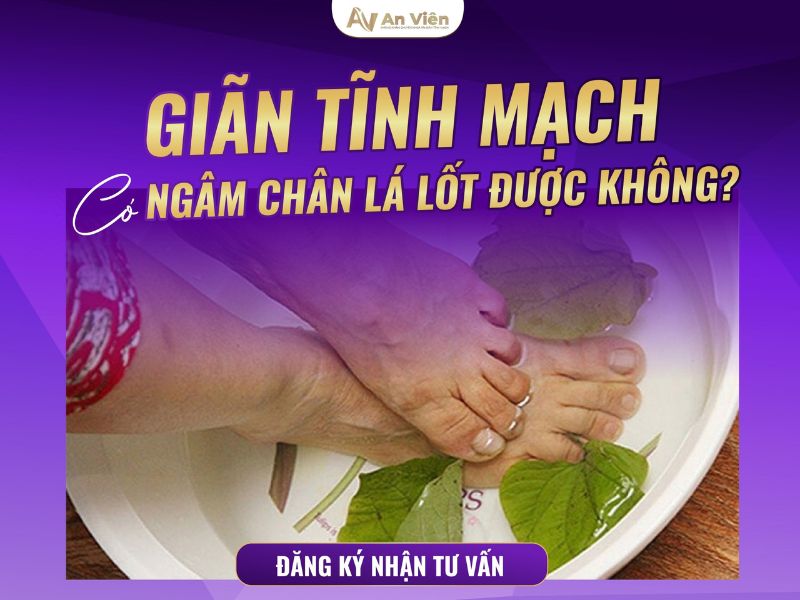 viêm tắc tĩnh mạch bàn chân