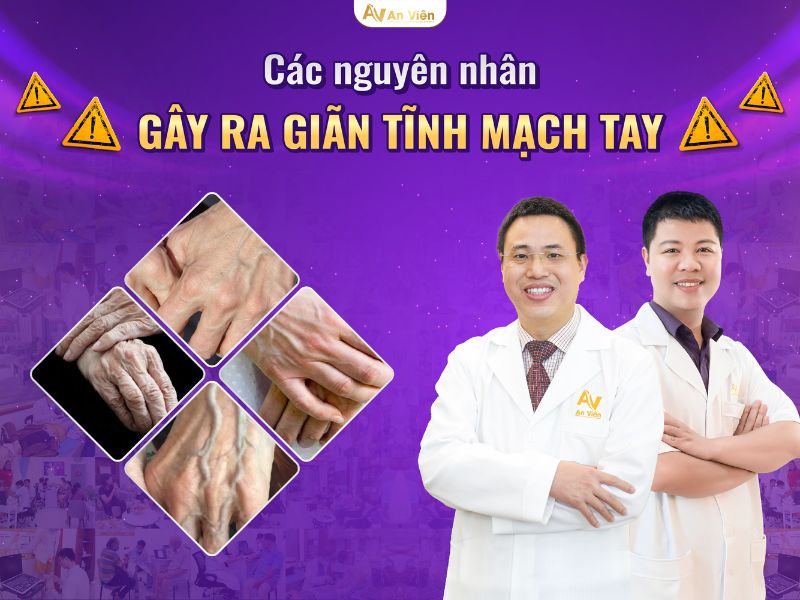 viêm tắc tĩnh mạch tay