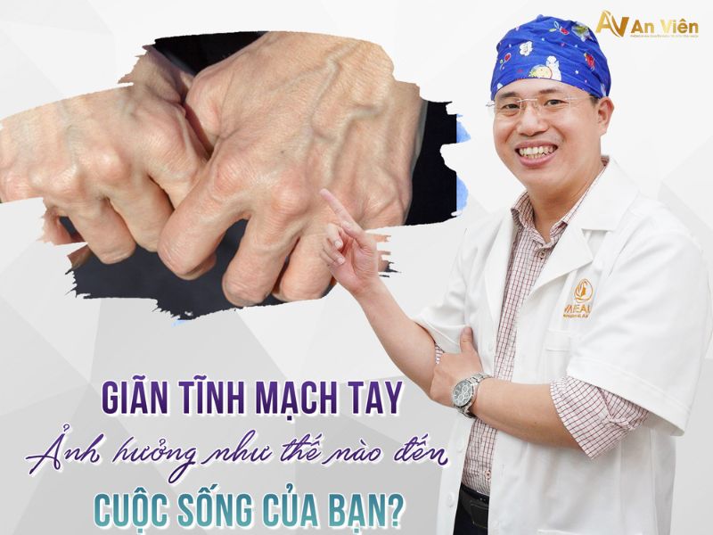 viêm tắc tĩnh mạch tay
