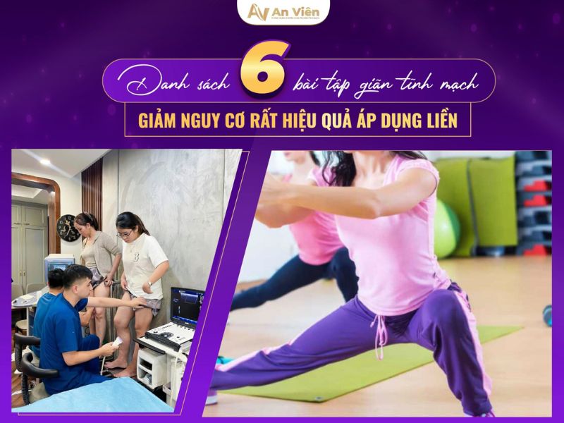 bài tập cho người bị suy giãn tĩnh mạch chân