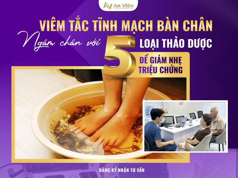 bàn chân bị giãn tĩnh mạch