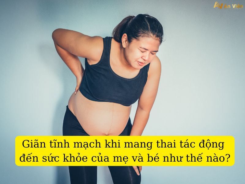 bầu giãn tĩnh mạch