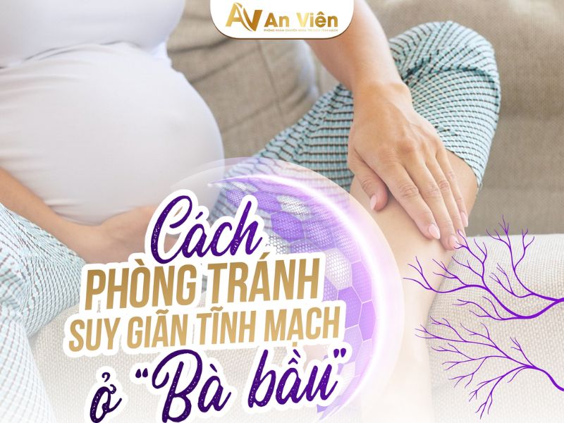 bầu giãn tĩnh mạch