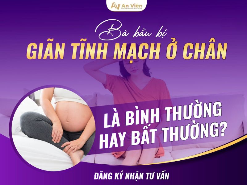 bầu giãn tĩnh mạch