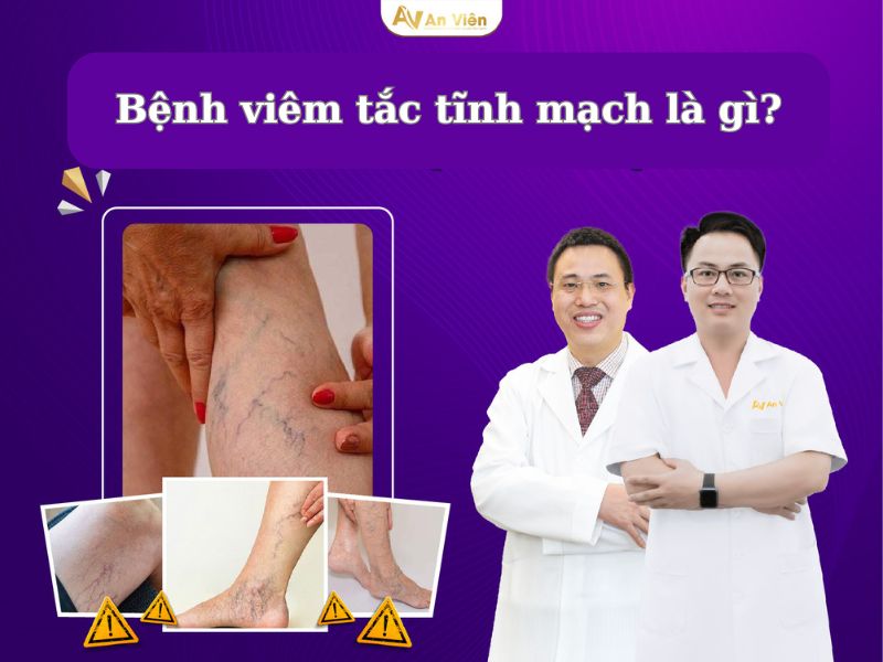 bệnh viêm tắc tĩnh mạch