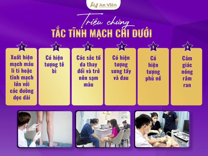 bệnh viêm tắc tĩnh mạch