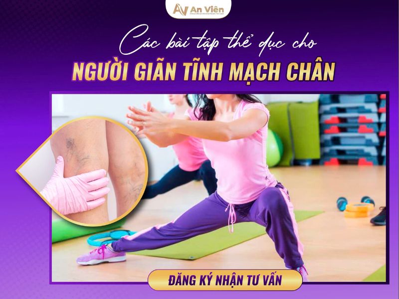bị giãn tĩnh mạch chân có nhảy dây được không