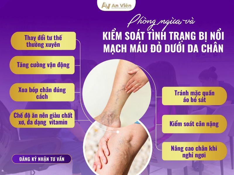 bị nổi mạch máu đỏ dưới da chân