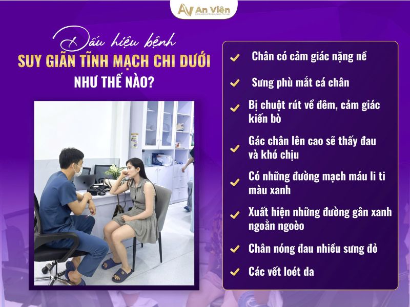 biểu hiện của bệnh giãn tĩnh mạch chân