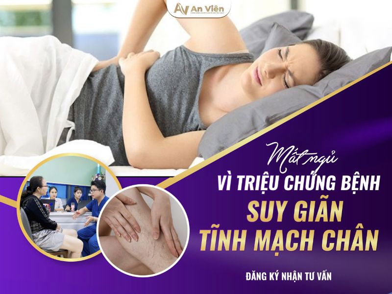 biểu hiện của bệnh giãn tĩnh mạch chân