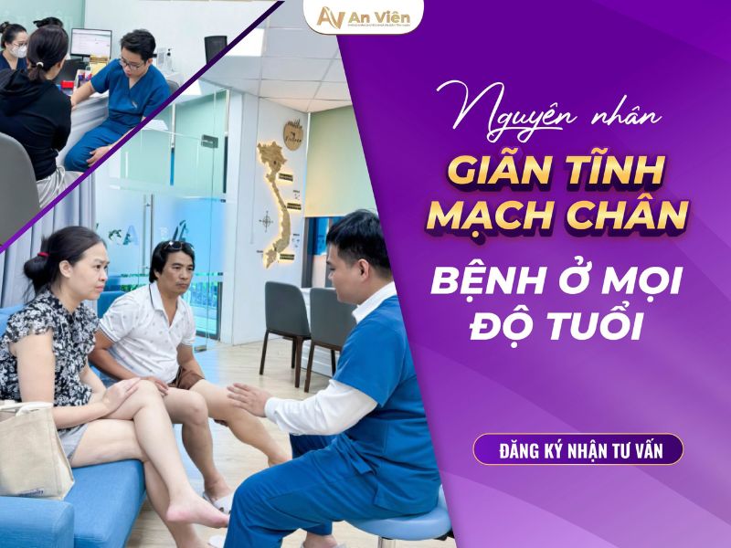 cách nhận biết giãn tĩnh mạch chân
