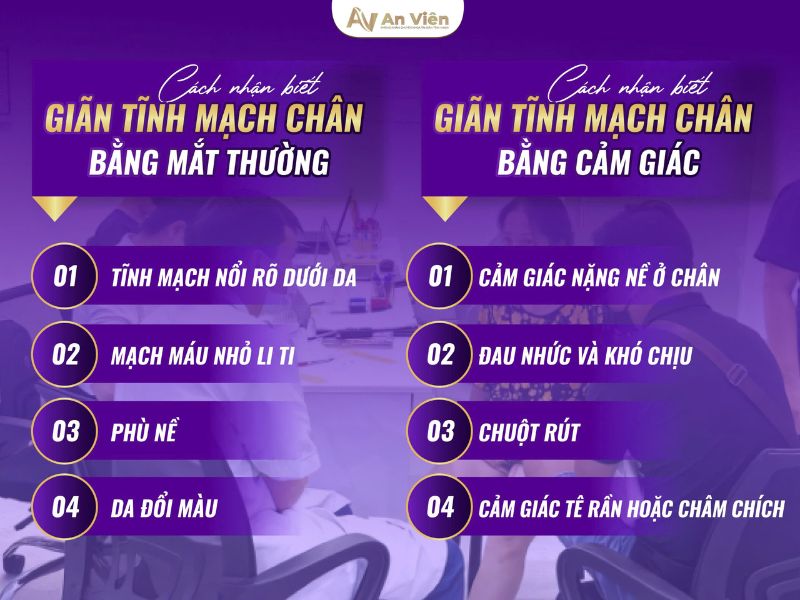 cách nhận biết giãn tĩnh mạch chân