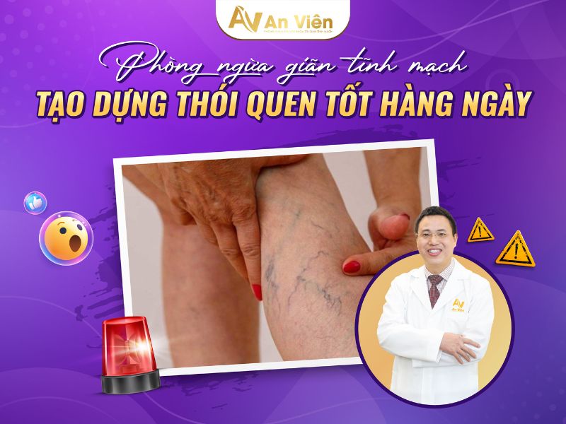cách nhận biết giãn tĩnh mạch chân