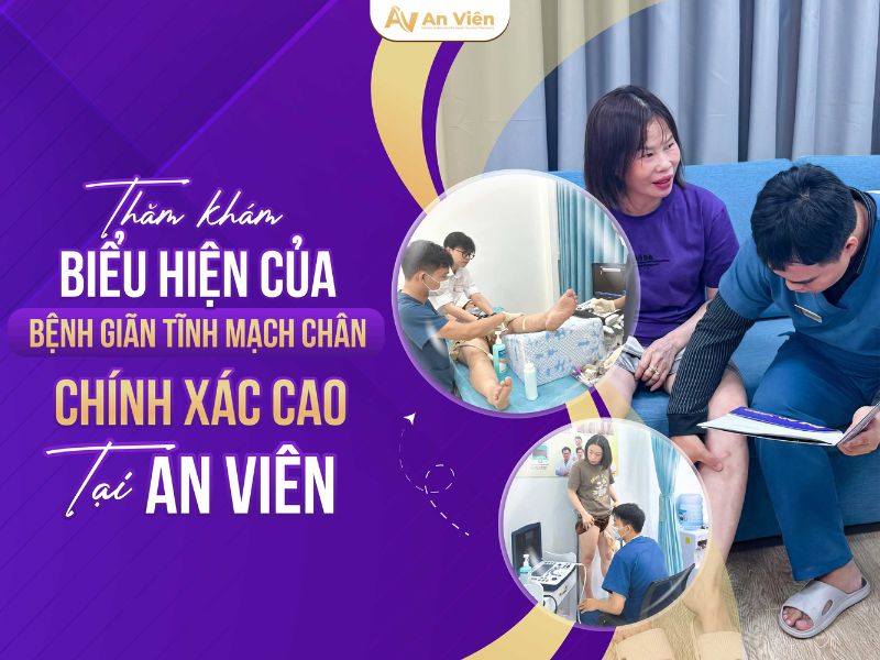 cách nhận biết giãn tĩnh mạch chân
