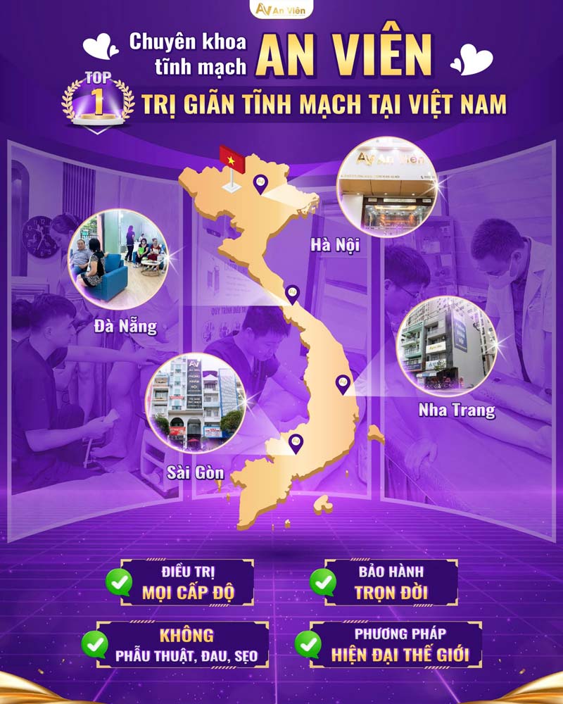 cách phòng chống suy giãn tĩnh mạch một
