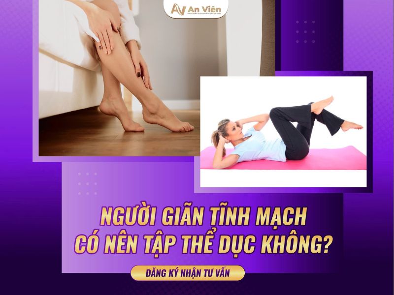 cách phòng ngừa giãn tĩnh mạch chân