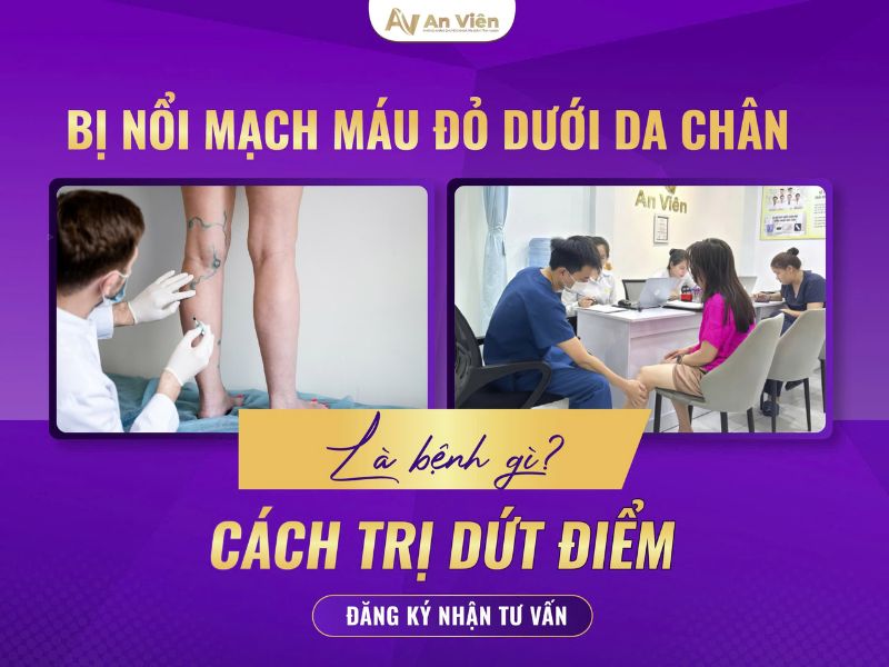 chân nổi nhiều mạch máu nhỏ