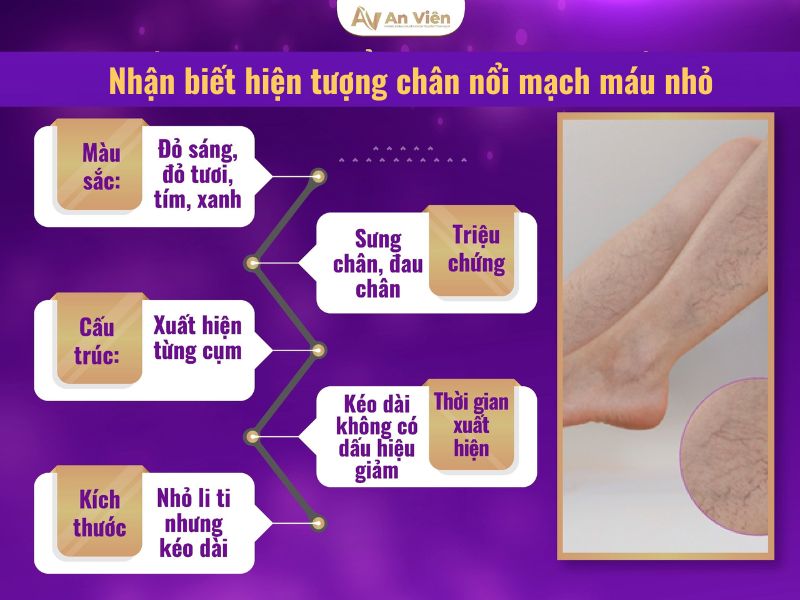 chân nổi nhiều mạch máu nhỏ