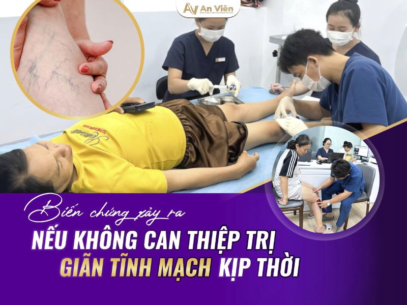 giãn tĩnh mạch ở chân có nguy hiểm không
