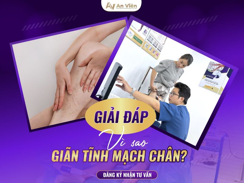 hẹp tĩnh mạch chân