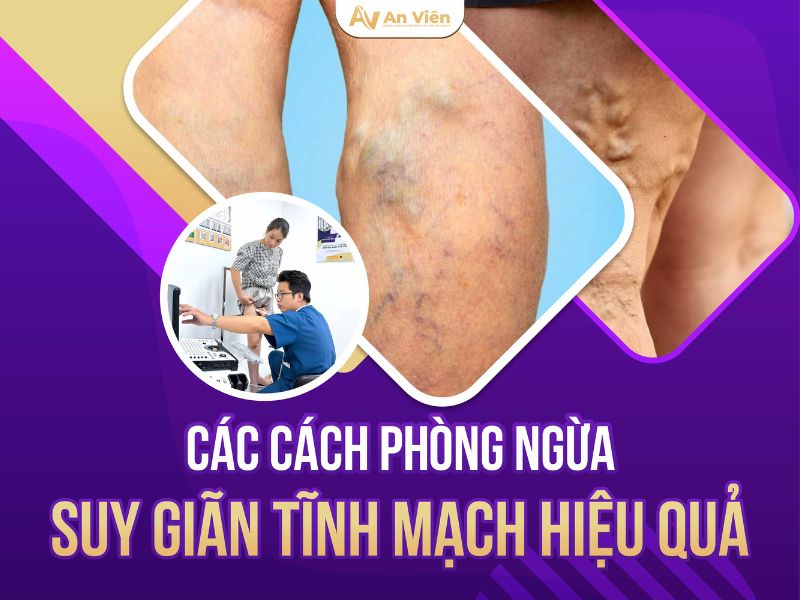 hẹp tĩnh mạch chân