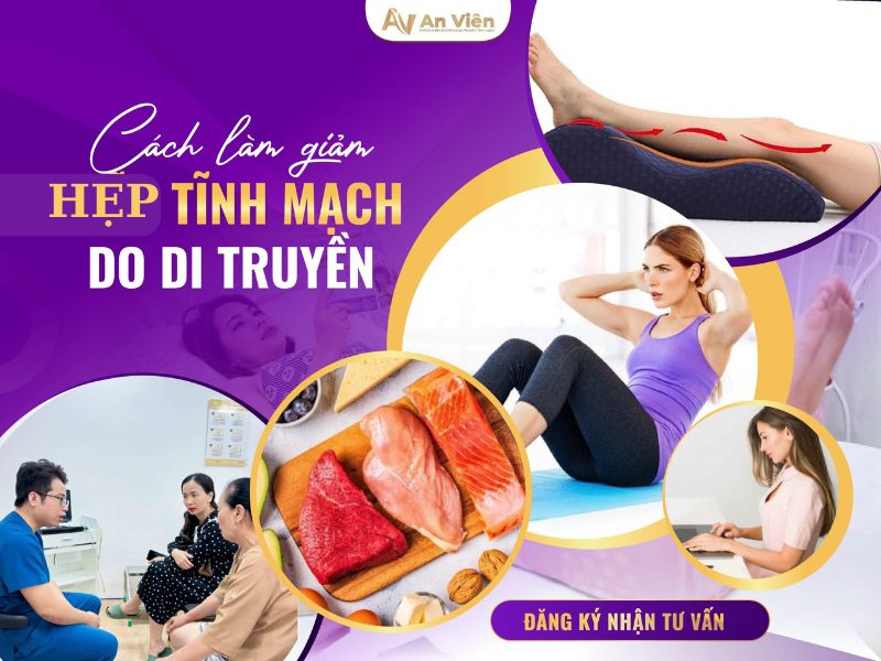 hẹp tĩnh mạch chân