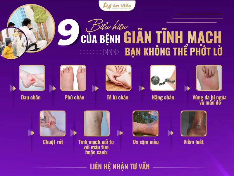 nguyên nhân suy giãn tĩnh mạch chân