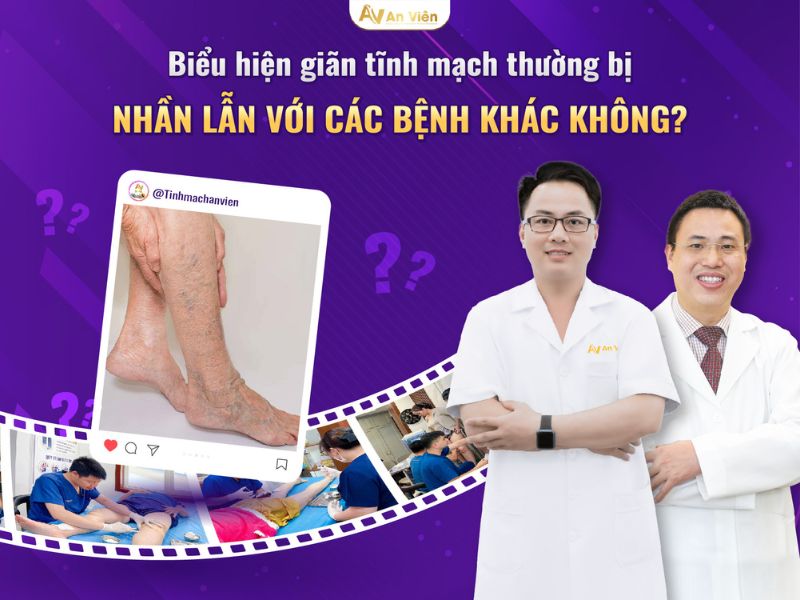 bể mạch máu ở chân