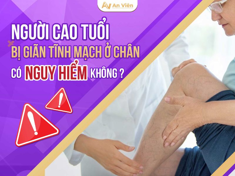bể mạch máu ở chân