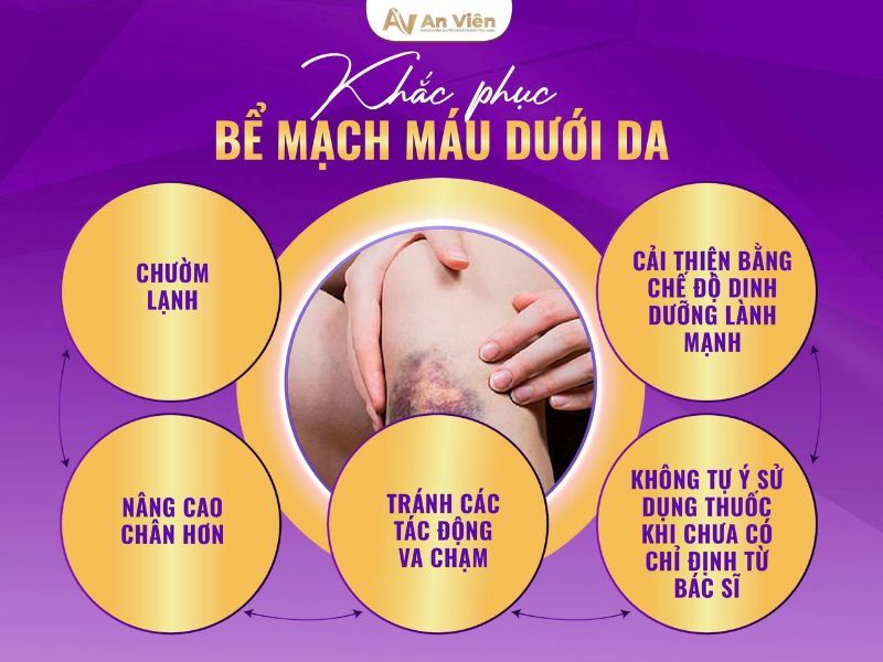 bể mạch máu ở chân