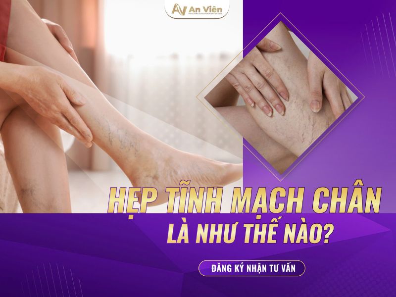 bệnh tĩnh mạch là gì