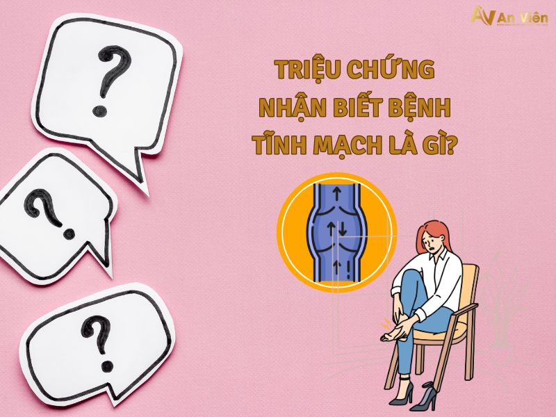 bệnh tĩnh mạch là gì