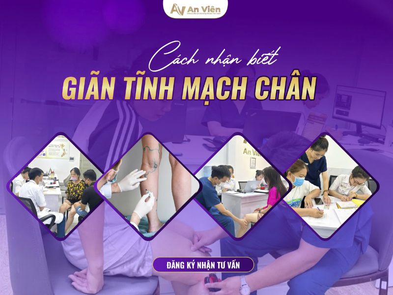 bệnh tĩnh mạch là gì