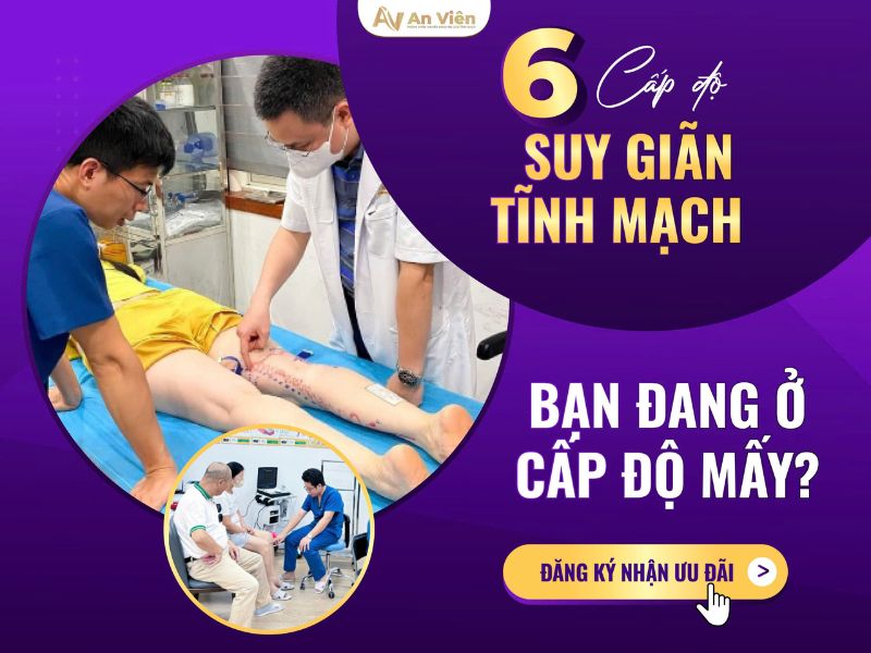 bệnh tĩnh mạch là gì
