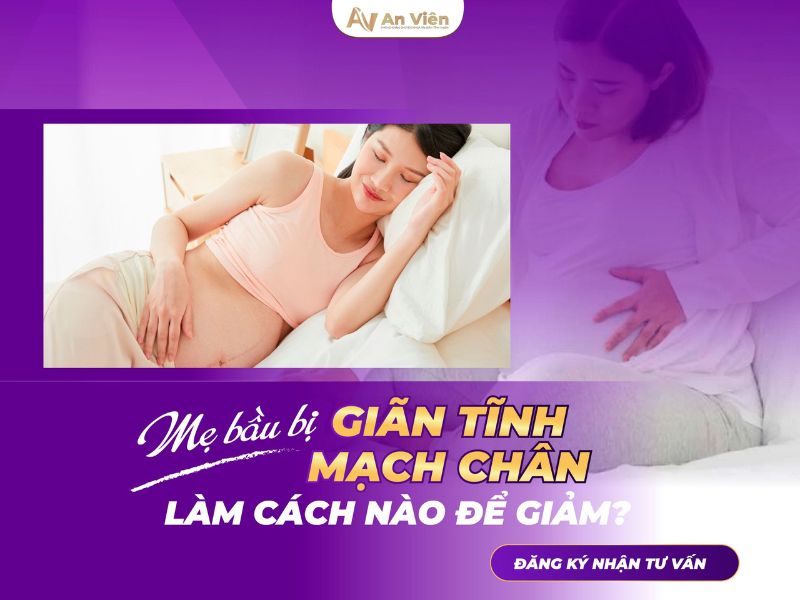 bị giãn tĩnh mạch chân khi mang thai