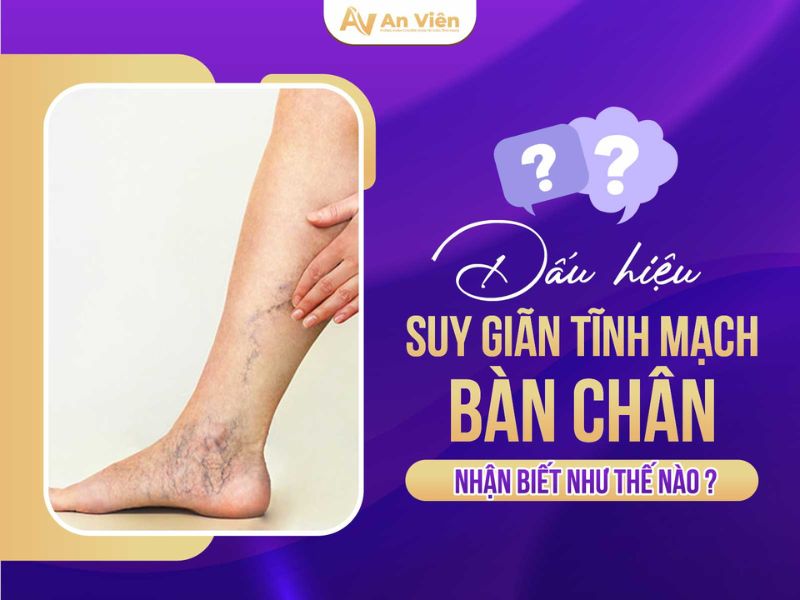 bị giãn tĩnh mạch chân khi mang thai