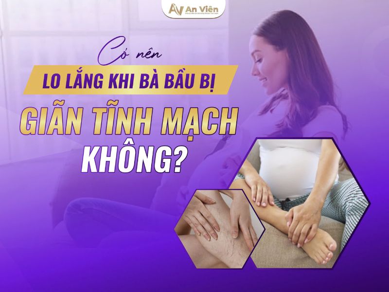 bị giãn tĩnh mạch chân khi mang thai