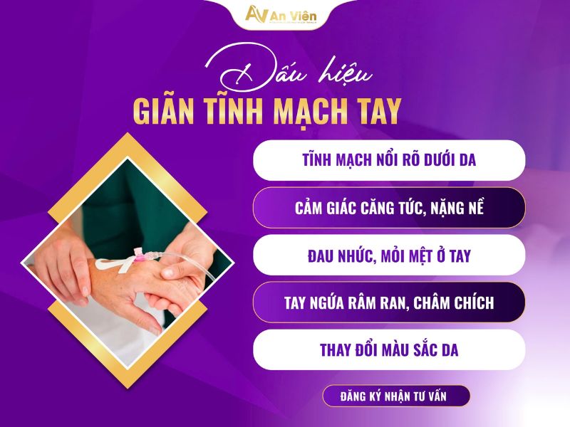 dấu hiệu giãn tĩnh mạch tay