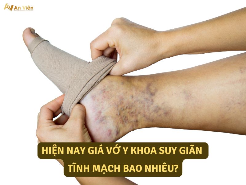 giá vớ y khoa suy giãn tĩnh mạch