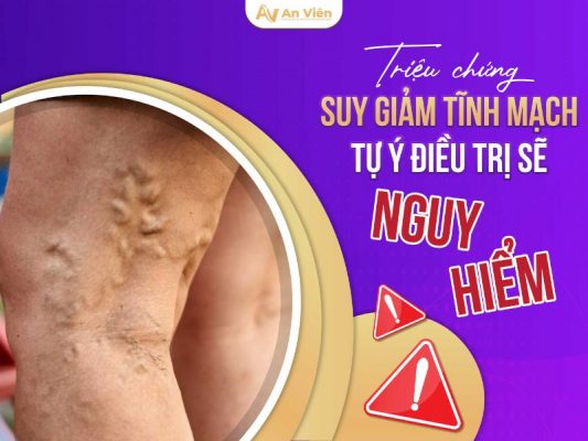 nguyên nhân suy giãn tĩnh mạch chân