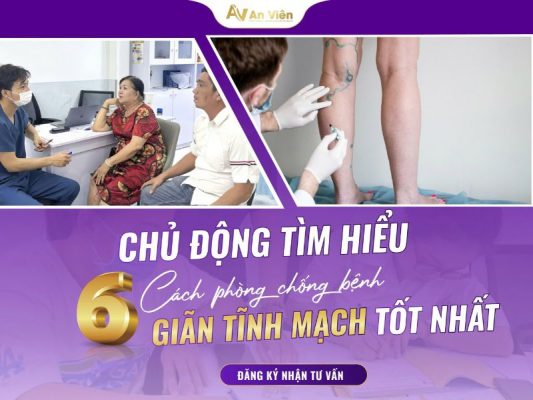 cách chữa suy giãn tĩnh mạch tay