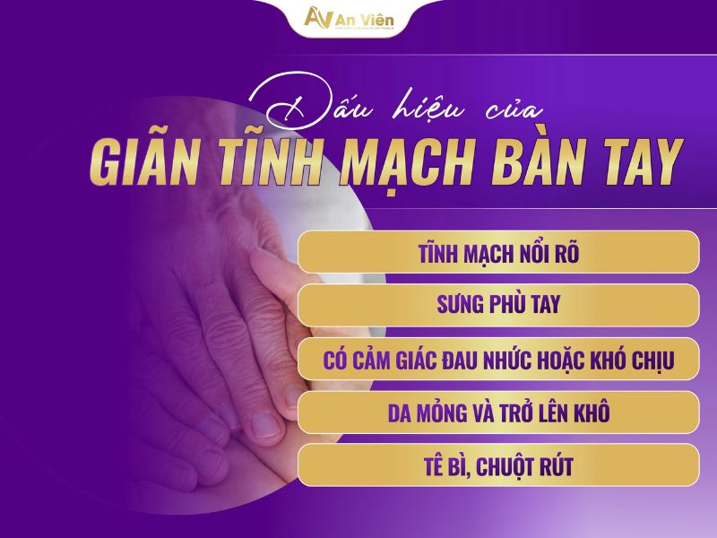 giãn tĩnh mạch bàn tay