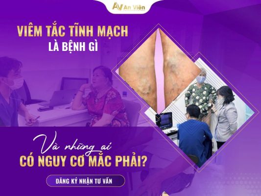 giãn tĩnh mạch khoeo chân